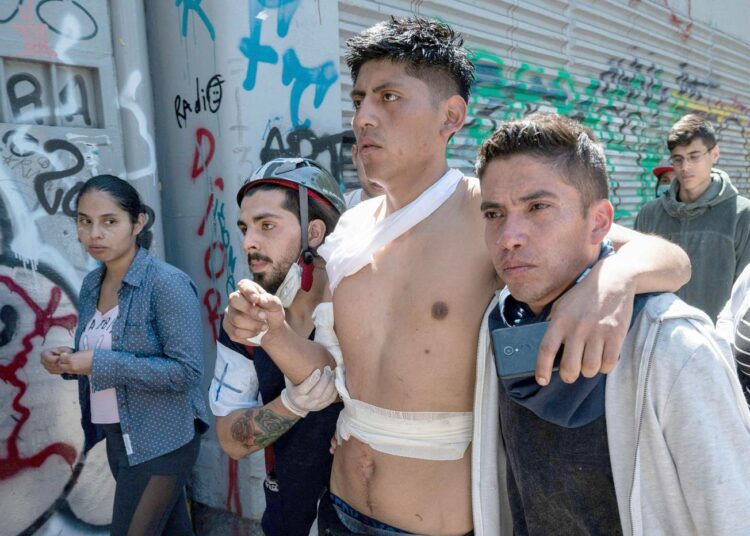 Mielenosoituksessa vammoja saanut nuori mies maanantaina Santiagossa.