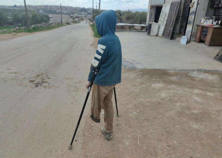 Salem al-Diyab menetti jalkansa Syyrian sodan aikana.