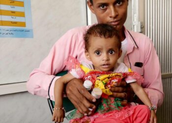 Isänsä Omarin sylissä istuva kymmenen kuukauden ikäinen Amara kärsii vakavasta aliravitsemuksesta.