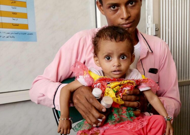 Isänsä Omarin sylissä istuva kymmenen kuukauden ikäinen Amara kärsii vakavasta aliravitsemuksesta.