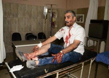 Haavoittunut mies odotti sunnuntaina hoitoa al-Razin sairaalassa Aleppossa hallituksen kontrolloimalla alueella.