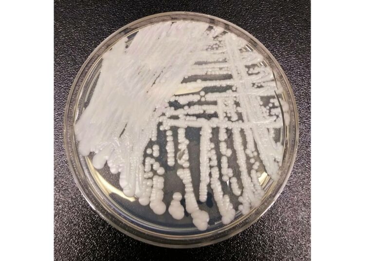 Candida auris -sientä viljeltynä petrimaljassa.