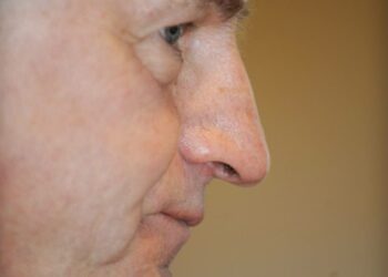 Ilpo Kokkila.