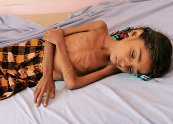 Kuvat Jemenin sodan aiheuttamasta nälänhädästä ovat alkaneet piinata yleisöä Yhdysvalloissa.