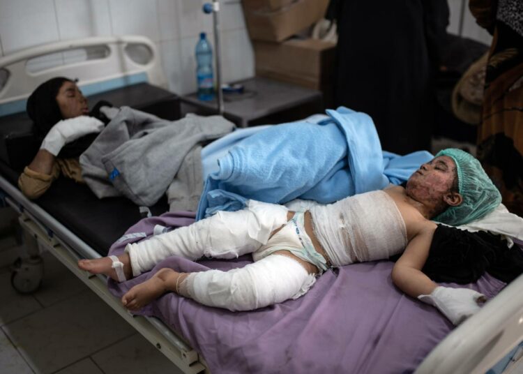 Palovammoja saaneita lapsia hoidettavana Hasakan sairaalassa 40 kilometrin päässä al-Holin leiristä. Tänne tuodaan vakavimmat tapaukset.