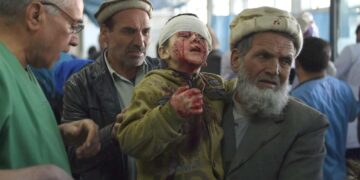 Autopommi-iskussa haavoittunutta lasta tuotiin Kabulissa sairaalaan tammikuussa.