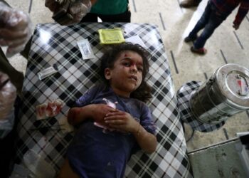 Haavoittunutta lasta hoidetaan kapinallisten hallussaan pitämässä Doumassa, joka sijaitsee Syyrian pääkaupungin itäpuolella. Ilmaiskut lisäävät paikallisten pelkoa, että sitä ryhdytään pommittamaan samalla tavalla kuin Aleppoa.