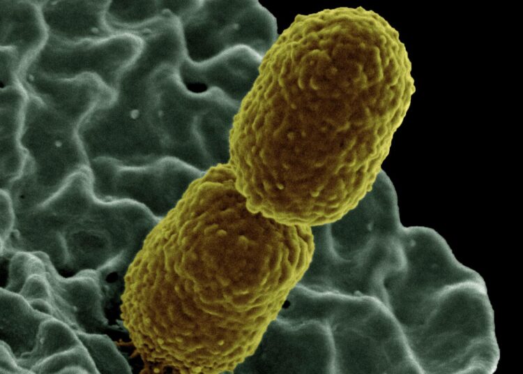 Klebsiella pneumoniae -keuhkokuumebakteeri.