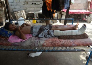 Viisitoistavuotiaan Ahmedin jalka ja käsi loukkaantuivat torille osuneessa ilmaiskussa.