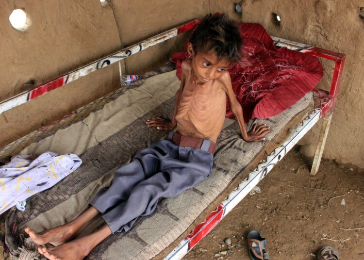 Maailman ruokaohjelma kutsuu Jemeniä maailman pahimmaksi humanitääriseksi kriisiksi. Kymmenvuotias Hassan Razem kuvattiin Jemenissä kesällä. Hän oli vakavasti aliravittu.
