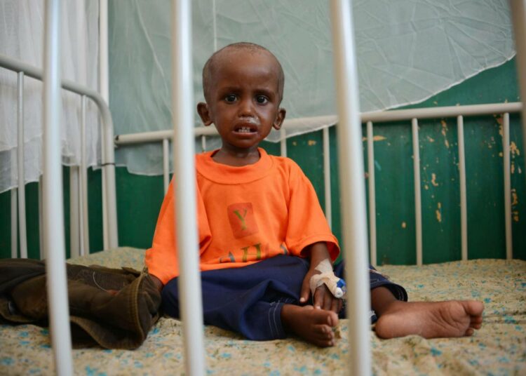 Nälänhädästä kärsivä lapsi mogadishulaisessa sairaalassa, Somaliassa.
