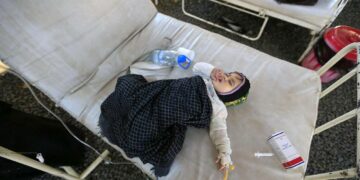 Koleraa sairastava lapsi Jemenin pääkaupungissa Sanaassa.