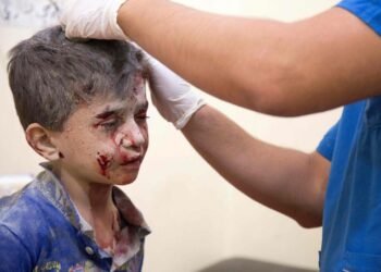 Syyrialainen poika saa hoitoa Aleppon itäosassa.