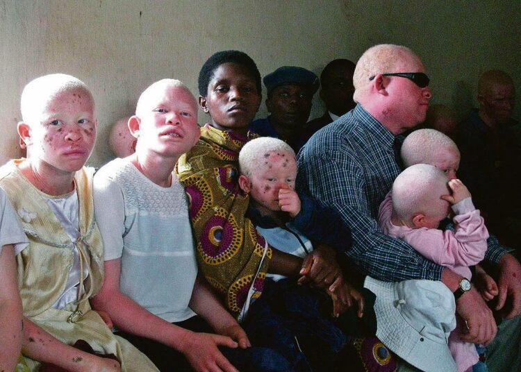 Albiinolapset vanhempineen seurasivat Ruyigissa Burundissa oikeudenkäyntiä, jossa burundilaismiehiä syytetään kahdeksanvuotiaan albiinotytön surmaamisesta ja ruumiinosien myymisestä naapurimaahan Tansaniaan.