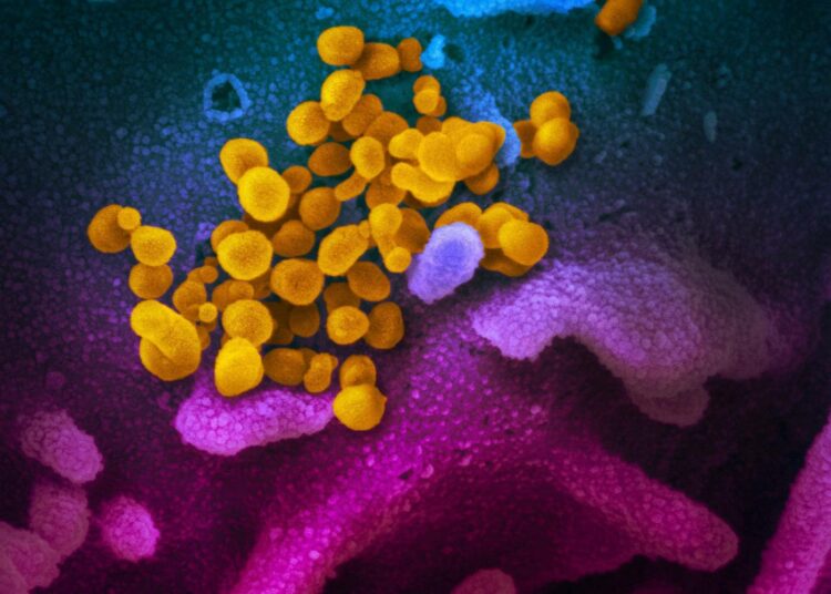 Elektronimikroskoopin kuvassa näkyy koronaviruksia (keltaiset) solun pinnalla.