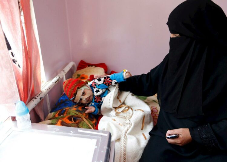 Jemenin konflikti on johtanut myös laajaan lasten aliravitsemukseen.