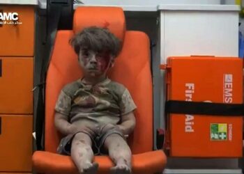 5-vuotias Omran Daqneesh on noussut Syyrian lasten kärsimyksen symboliksi.