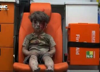 5-vuotias Omran Daqneesh on noussut Syyrian lasten kärsimyksen symboliksi.