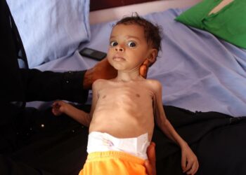 Suurten nälänhätien katsottiin jo hävinneen, sillä 2000-luvulla niitä on ollut vain yksi, liki vuosikymmen sitten Somaliassa. Kuva Jemenistä vuodelta 2019.