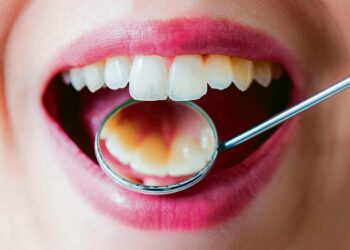 Hammaslääkärissä käynti on kallista, eikä pienituloisilla ole usein varaa hoitaa hampaitaan. Siksi hymy voi paljastaa ihmisen yhteiskunnallisen aseman ilman suupeiliäkin.