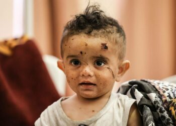 Palestiinalaistyttö saamassa hoitoa Israelin ilmaiskuissa saamiinsa vammoihin Gazassa.