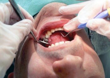 Kuntatyönantajien KT:n työmarkkinajohtaja Markku Jalosen mukaan esimerkiksi lääkäreiden ja hammaslääkäreiden työajoissa on harmonisointitarpeita.