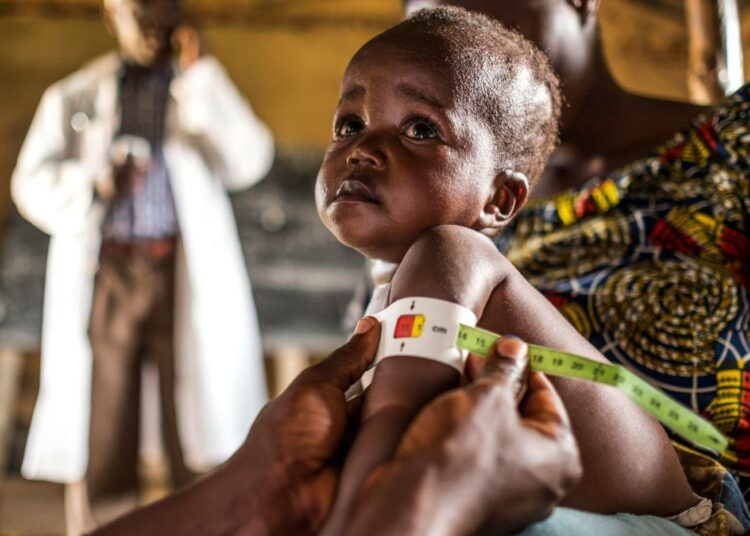 Pikkulapsi mitattavana terveyskeskuksessa Kongon demokraattisen tasavallan Mbaussa.