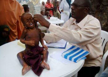 Lääkäri tutkii lasta ruoanjakelupisteessä Mogadishussa, Somaliassa.