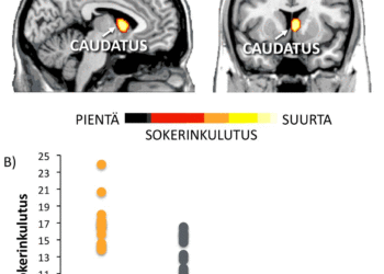 Mielihyvän kokemuksia käsittelevän caudatus-tumakkeen (A)  sokerinkulutus oli merkittävästi suurempaa lihavilla kuin normaalipainoisilla  henkilöillä (B).